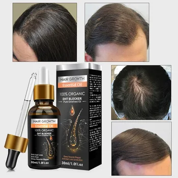 30ML de gengibre cabelo, óleo essencial de Anit a perda de cabelo profundo nutrir reparação de cuidados com os cabelos massagem com óleo essencial, óleo de crescimento do Cabelo
